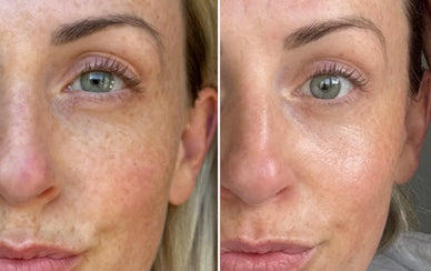 Revitalize Your Health and Glow with Confidence